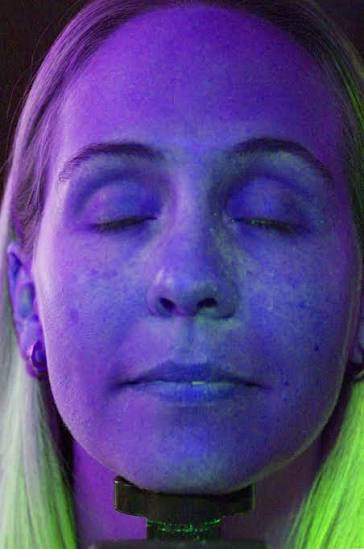 It's More Than Just a Tan: The Skin Damage Caused by UV Lamps Is Far More Serious Than You Think