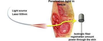 Photodynamic Therapy 2.0: How 630nm Liquid-Cooled Lasers Are Obliterating Tumors