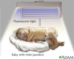 Blue Light Revolution: How Fiber-Optic Phototherapy Is Slashing Newborn Jaundice Dangers